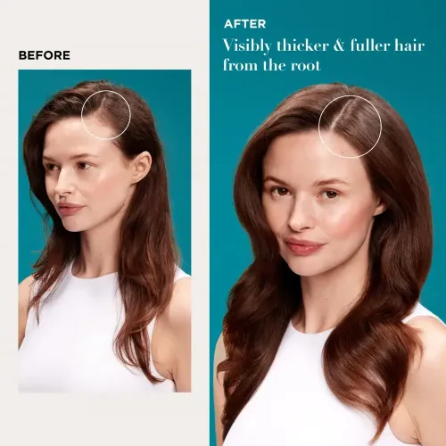 سيروم ProGrowth + Peptide لفروة الرأس من OGX 