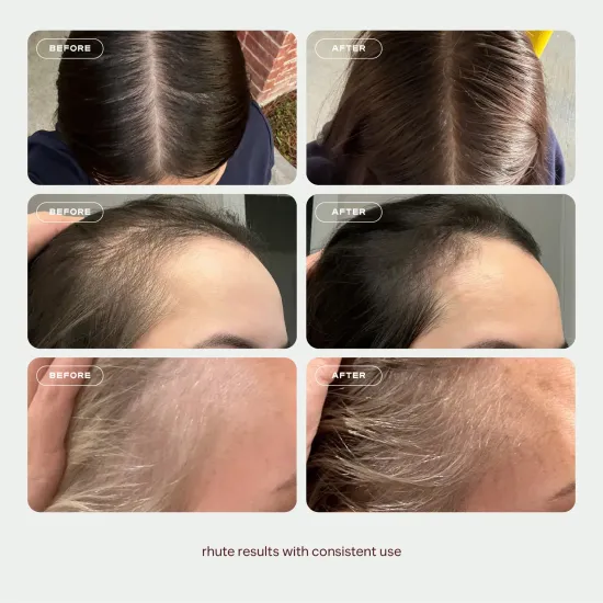  سيروم Rhute لفروة الرأس لتعزيز كثافة الشعر وإصلاحه (50 مل)