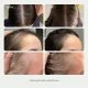  سيروم Rhute لفروة الرأس لتعزيز كثافة الشعر وإصلاحه (50 مل)