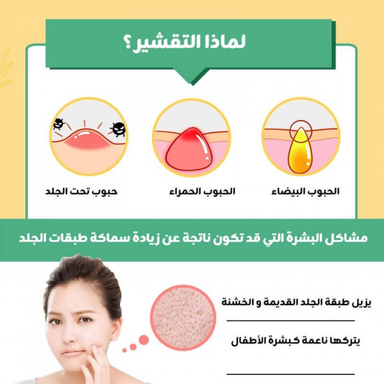 جل التقشير بالصبار جل التقشير بالصبار