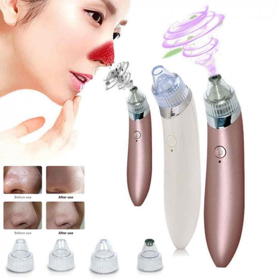 جهاز شفط دهون و زيوان و رؤس سوداء البشره بعدة مقاسات - شحن 