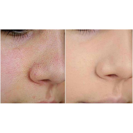 برايمر بيبي سكين من ميبلين  20 مل