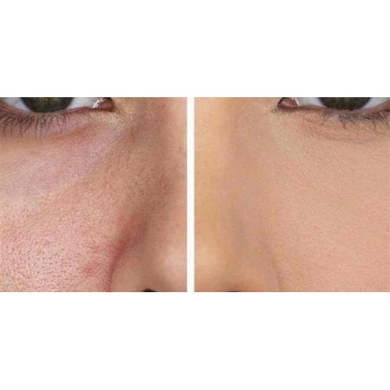 برايمر بيبي سكين من ميبلين  20 مل