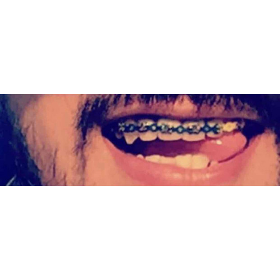 تقويم ازرق متصل ، زينه اكسسوار مؤقت 