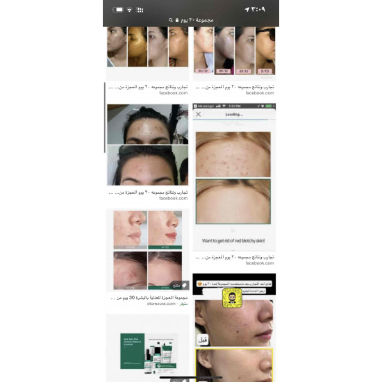 مجموعة المعجزه 30 يوم ، سوم باي مي لمعالجة البشره