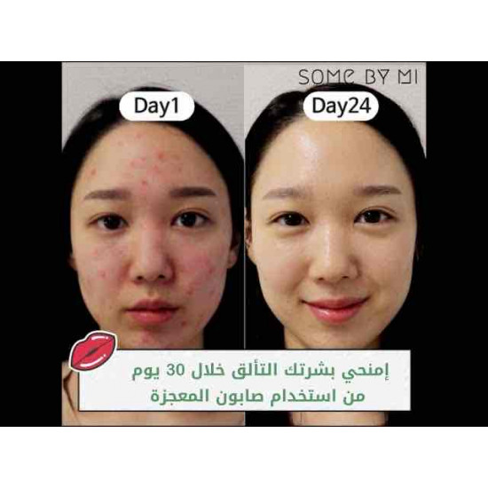 مجموعة المعجزه 30 يوم ، سوم باي مي لمعالجة البشره