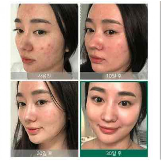 مجموعة المعجزه 30 يوم ، سوم باي مي لمعالجة البشره