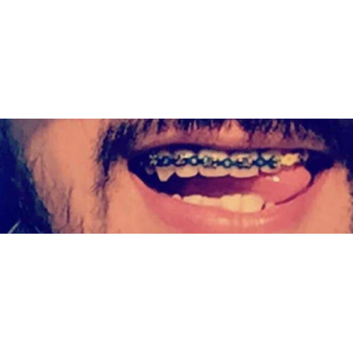 تقويم ازرق متصل ، زينه اكسسوار مؤقت 