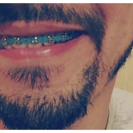 تقويم سماوي متصل - زينه اكسسوار مؤقت