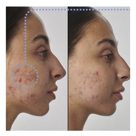 سيروم الريتنول الفائق 1% من ذا إنكي ليست 30مل