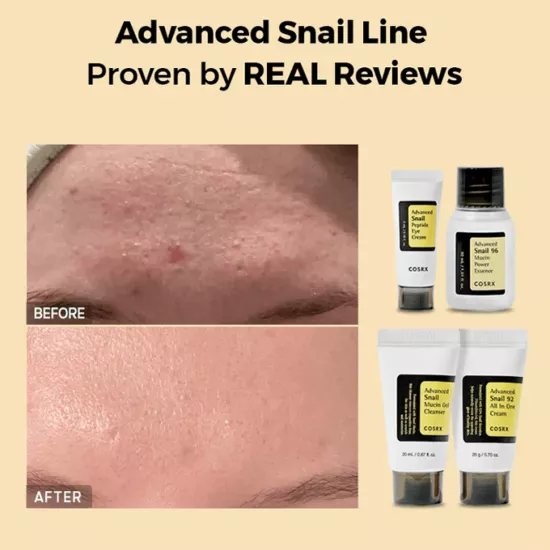 مجموعة الحلزون لترطيب البشرة من كوسركس- 4 قطع