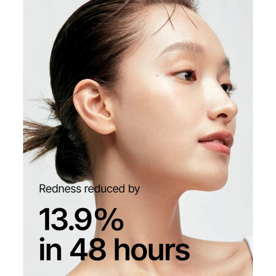 تونر الهارت ليف 77% لتهدئة البشرة من انوا - 250مل