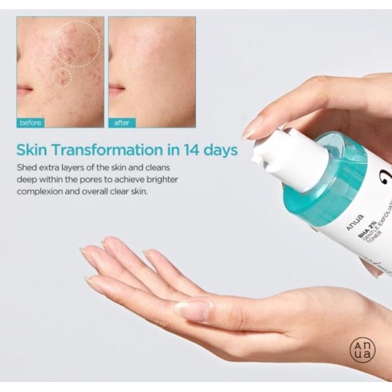 تونر مقشر BHA 2% لطيف من انوا , 150مل تونر مقشر BHA 2% لطيف من انوا , 150مل