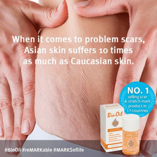 زيت العناية بالبشرة من بيو اويل 125مل زيت العناية بالبشرة من بيو اويل 125مل