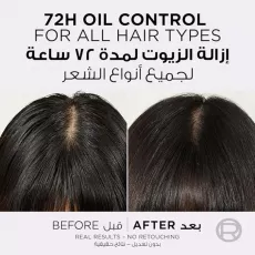 شامبو الفيف هيالورون بيور للشعر الدهني من لوريال باريس - 400 مل شامبو الفيف هيالورون بيور للشعر الدهني من لوريال باريس - 400 مل