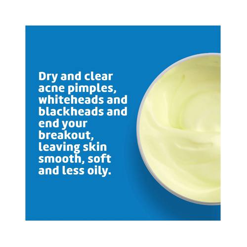 كريم اكني لعلاج حب الشباب مع 10% كبريتات