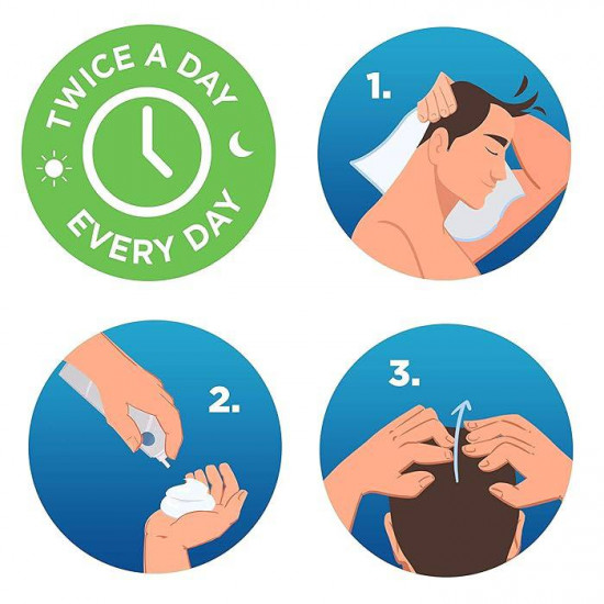 رغوة روجين مينوكسيديل 5% للرجال لتساقط الشعر وإعادة نموه، علاج موضعي للشعر الخفيف