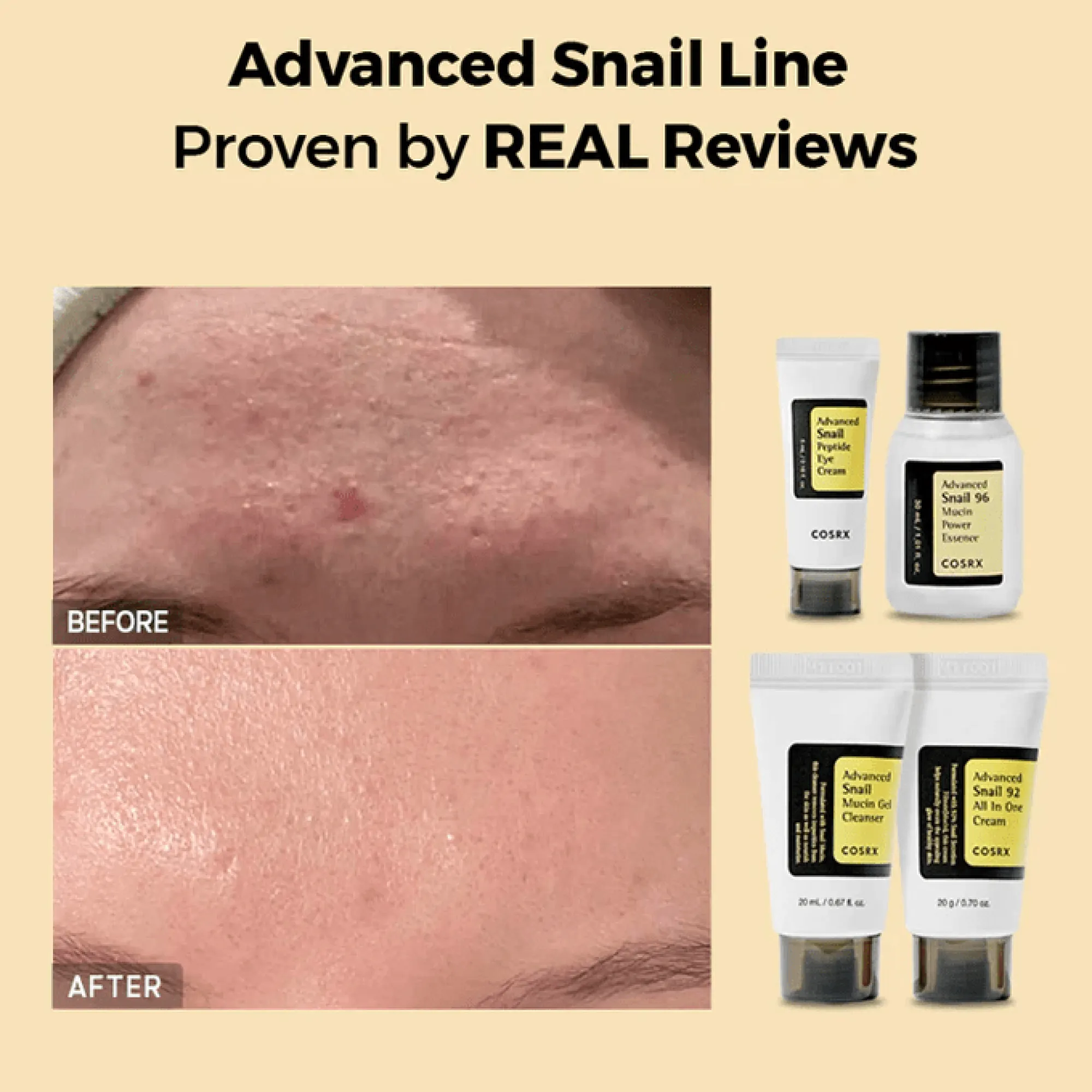 مجموعة الحلزون لترطيب البشرة من كوسركس- 4 قطع