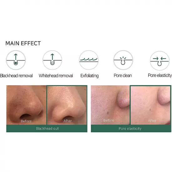 غسول الرؤوس السوداء من سوم باي مي