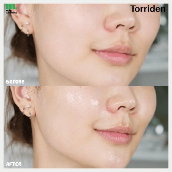 توريدين دايف إن سيروم حمض الهيالورونيك منخفض الجزيئات لجميع أنواع البشرة 50 مل