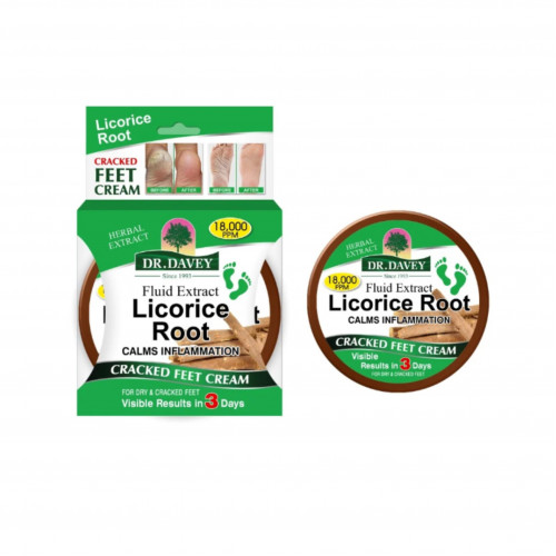 كريم بعرق السوس لتشقق القدمين من دكتور ديفي