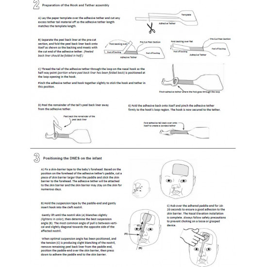 اداة لشد الانف خاصة بالشفة الارنبية
