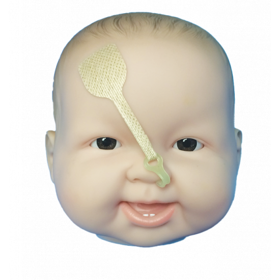 اداة لشد الانف خاصة بالشفة الارنبية