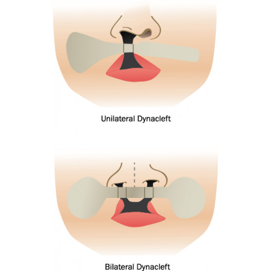 اداة مساعدة خاصة لشفة الارنبية جهتين