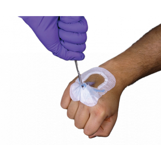 ﺳورﺑﺎ ﻓﯾو ﺷﯾﻠد ﻣﺛﺑت ﻟﻠﻘﺳطرة اﻟورﯾدﯾﺔ ﻣن طﺑﻘﺎت ﻣﺗﻌددة ﻣﻊ اﻟﻣدﻋم اﻟﺧﺎص ﺗﺛﺑت ﻟﻣدة 7 اﯾﺎم ﻣﻘﺎس وسط SORBAVIEW® SHIELD Peripheral ﺳورﺑﺎ ﻓﯾو ﺷﯾﻠد ﻣﺛﺑت ﻟﻠﻘﺳطرة اﻟورﯾدﯾﺔ ﻣن طﺑﻘﺎت ﻣﺗﻌددة ﻣﻊ اﻟﻣدﻋم اﻟﺧﺎص ﺗﺛﺑت ﻟﻣدة 7 اﯾﺎم ﻣﻘﺎس وسط SORBAVIEW® SHIELD Peripheral