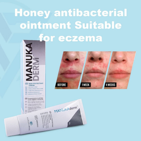 كريم للجلد من عسل المانوكا الاصلي لترطيب الجلد وتخفيف الالتهاب والحكة حجم 50 جرام منوكاديرم