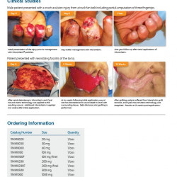 MicroMatrix®  ACell’s wound management products