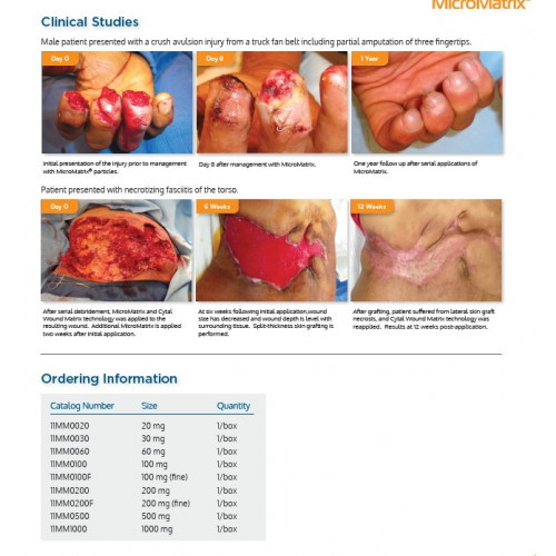 MicroMatrix®  ACell’s wound management products