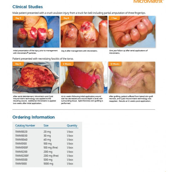 MicroMatrix® ACell’s wound management products MicroMatrix® ACell’s wound management products