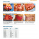 MicroMatrix® ACell’s wound management products MicroMatrix® ACell’s wound management products