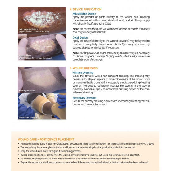 MicroMatrix® ACell’s wound management products MicroMatrix® ACell’s wound management products