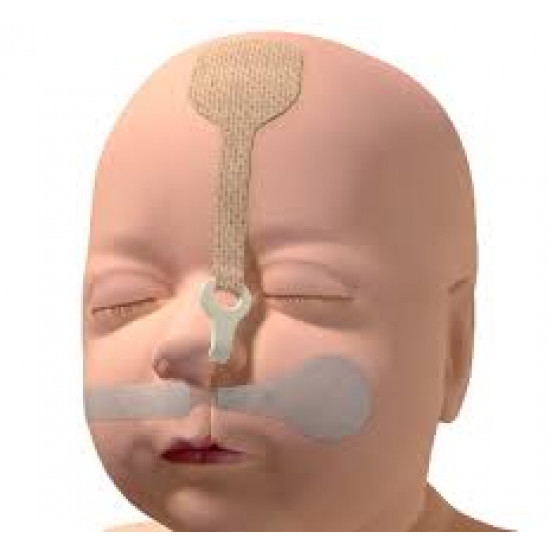 اداة مساعدة خاصة لشفة الارنبية جهة واحدة 