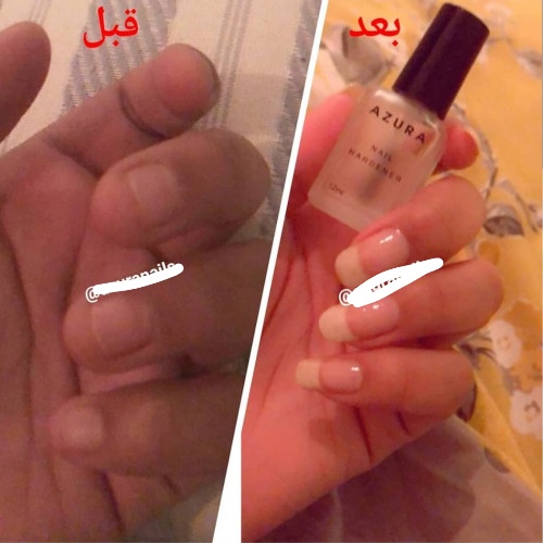 ازورا مقوي أظافر - 12 مل ازورا مقوي أظافر - 12 مل