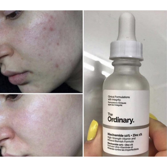 سيروم مكافحة التصبغات و المسام ذا اورديناري - زينك 1% ز نيساناميد 10% - 30مل سيروم مكافحة التصبغات و المسام ذا اورديناري - زينك 1% ز نيساناميد 10% - 30مل