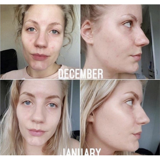 سيروم مكافحة التصبغات و المسام ذا اورديناري - زينك 1% ز نيساناميد 10% - 30مل سيروم مكافحة التصبغات و المسام ذا اورديناري - زينك 1% ز نيساناميد 10% - 30مل