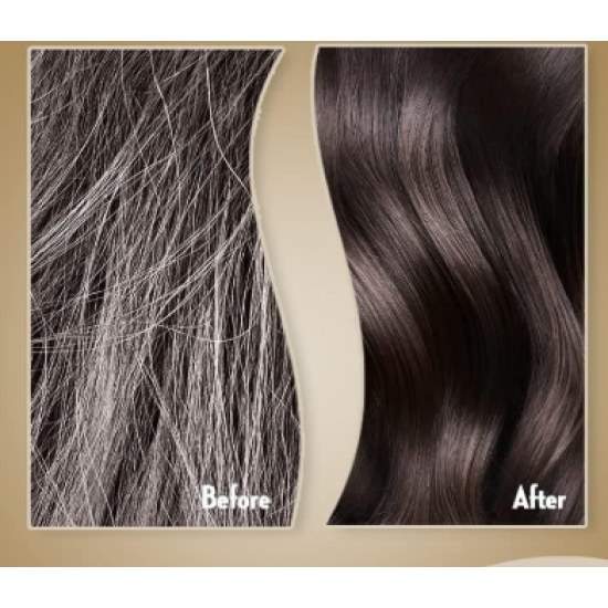 بلسم صانسيلك الحل لتساقط الشعر 350 ملي 