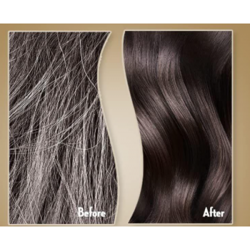 شامبو صانسيلك الحل بتساقط الشعر 700 ملي شامبو صانسيلك الحل بتساقط الشعر 700 ملي