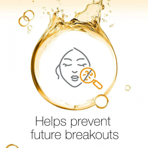 نيوتروجينا غسول الوجه للتحكم بحبوب الوجه - 200 مل