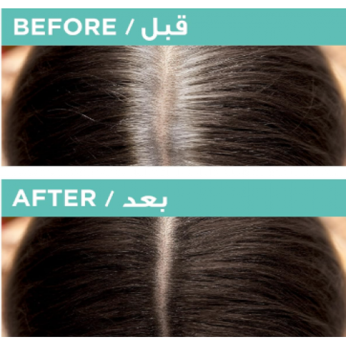 لوريال باريس ماجيك ريتوتش ، خافي عيوب فورية ، بني غامق لوريال باريس ماجيك ريتوتش ، خافي عيوب فورية ، بني غامق