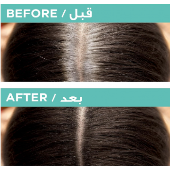 لوريال باريس ماجيك ريتوتش ، خافي عيوب فورية ، بني غامق لوريال باريس ماجيك ريتوتش ، خافي عيوب فورية ، بني غامق