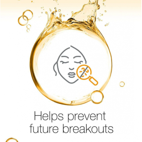 نيوتروجينا غسول الوجه للتحكم بحبوب الوجه - 200 مل