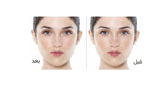 طقم اشرط تنظيف الانف من 4 قطع ابيض من كايلان 200ج