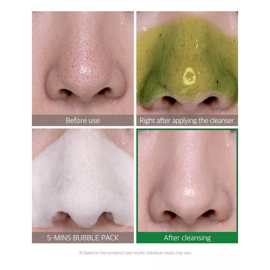 غسول المعجزه وداعا للرؤوس السوداء من سوم باي مي غسول المعجزه وداعا للرؤوس السوداء من سوم باي مي