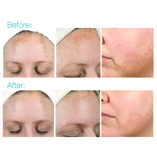 كريم تفتيح التصبغات والبقع الداكنه من بي اف بي فانيش كريم تفتيح التصبغات والبقع الداكنه من بي اف بي فانيش