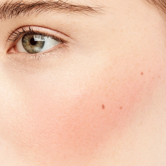 بلاشر اورجازم السائل من نارس بلاشر اورجازم السائل من نارس