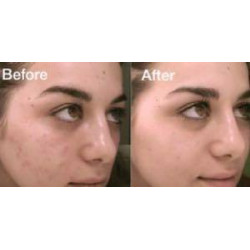 سيروم ألفا أربوتين 2% + Ha لمعالجه البقع والتصبغات من ذا اورديناري سيروم ألفا أربوتين 2% + Ha لمعالجه البقع والتصبغات من ذا اورديناري